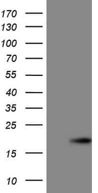 p16INK4a / CDKN2A Antibody (clone OTI1E7)