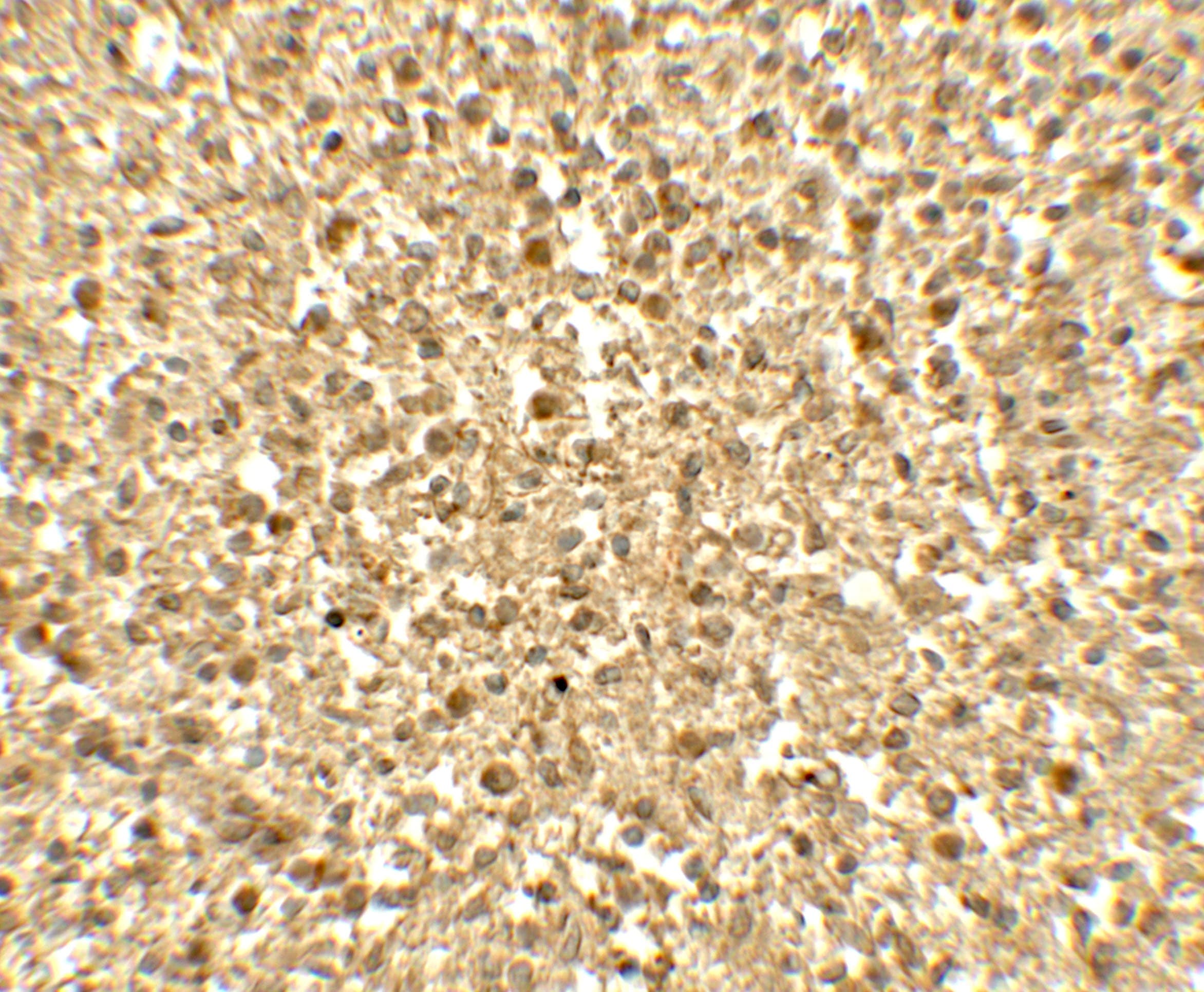 SREBF1 / SREBP-1 Antibody