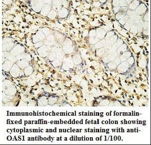 OAS1 Antibody (aa1-215)