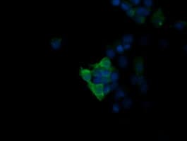 MAPK13 / p38delta Antibody (clone OTI12B6, Carrier-free)