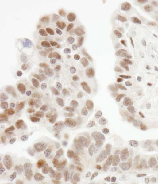 ZHX1 Antibody (aa1-50)