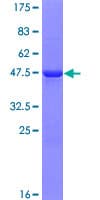 Human NIP7 Protein (Recombinant GST)