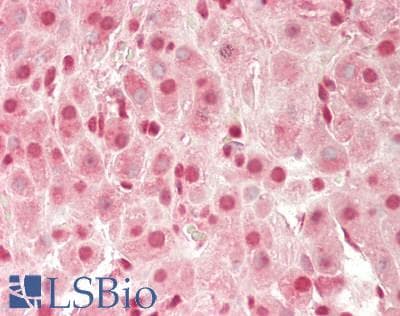 CREM / ICER Antibody (Internal)