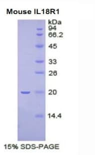 Mouse CDw218a / IL18R1 Protein (Recombinant His, N-Terminal)