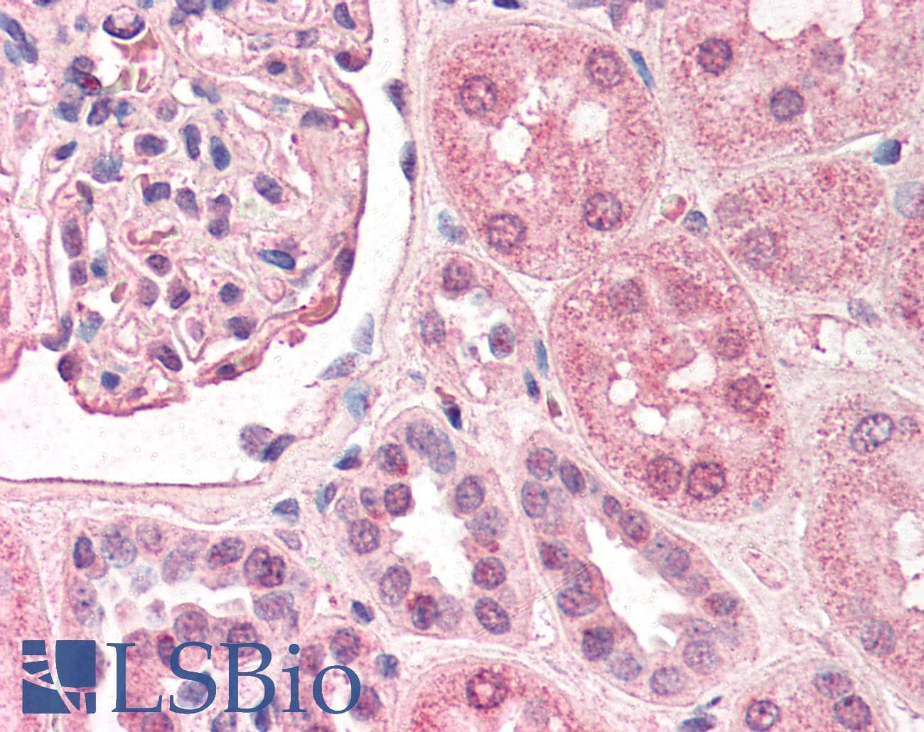 IHC-plus™ Polyclonal Goat anti-Human TFAP2A / AP-2 Antibody (aa1-25, IHC, WB)