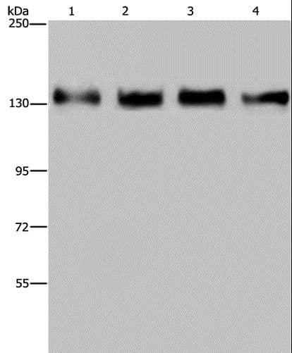 Polyclonal Rabbit anti-Human GOLGA2 / GM130 Antibody (IHC, WB)