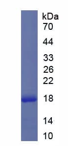 Human IL36RN / IL1F5 Protein (Recombinant His)