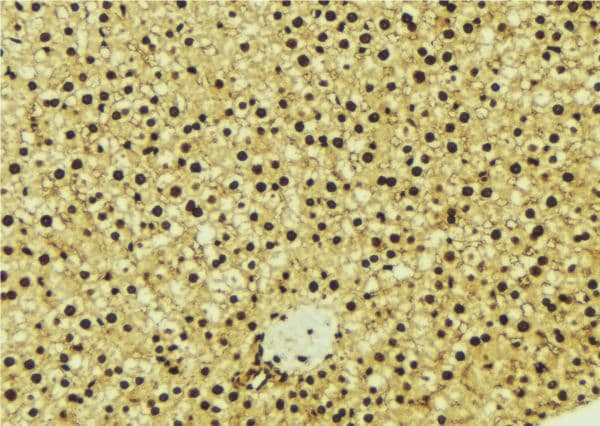 OGT / O-GLCNAC Antibody