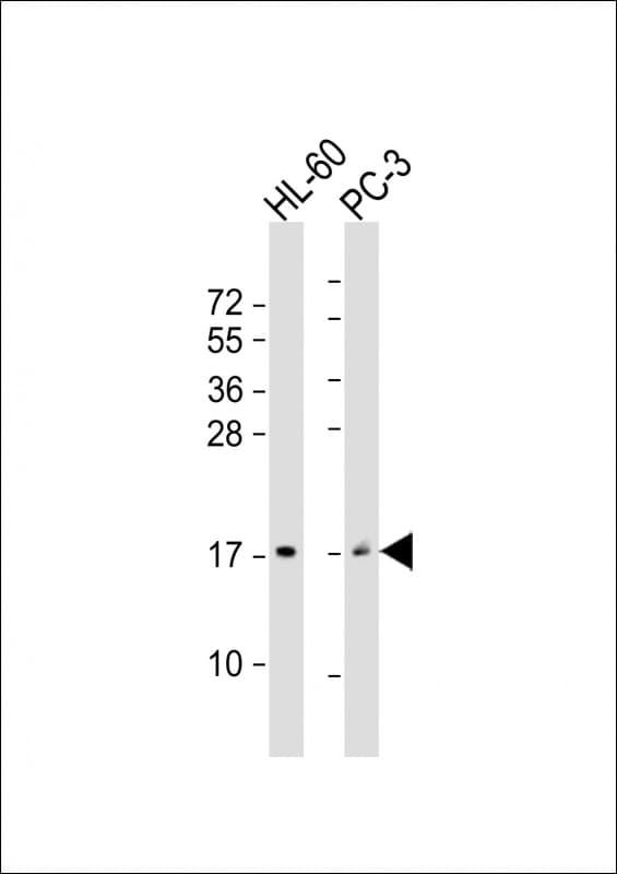 Gastrin Releasing Peptide Antibody (aa67-97)