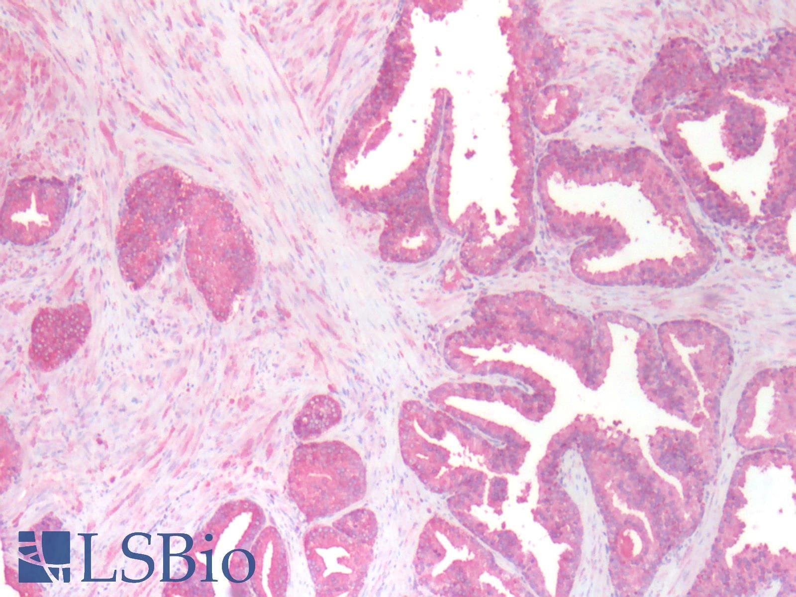 IHC-plus™ FAP Alpha Antibody (Extracellular Domain)