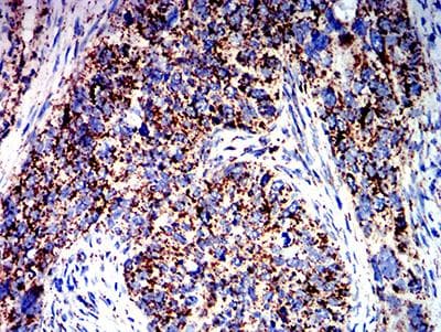 ATPIF1 / ATPI Antibody (clone 1F3B8)