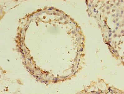 C19orf47 Antibody