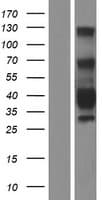 TMEM25 Protein (Over-Expression Lysate Myc-DDK (Flag))