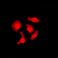 Polyclonal Rabbit anti-Human IK3-1 / CABLES1 Antibody (C-Terminus, IHC, IF, WB)