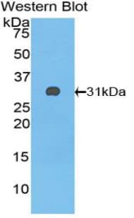 CFH / Complement Factor H Antibody (aa915-1156)