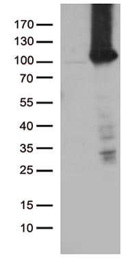 TTC7A Antibody (aa1-450, clone OTI1D4, Carrier-free)