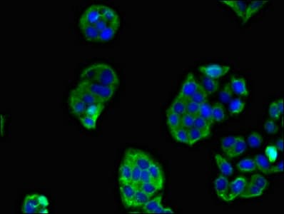 Polyclonal Rabbit anti-Human SCTR / SR / Secretin Receptor Antibody (IHC, IF)