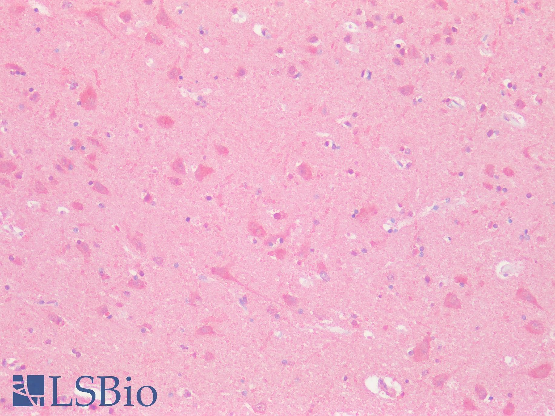 PathPlus™ GPRC5D Antibody (N-Terminus)