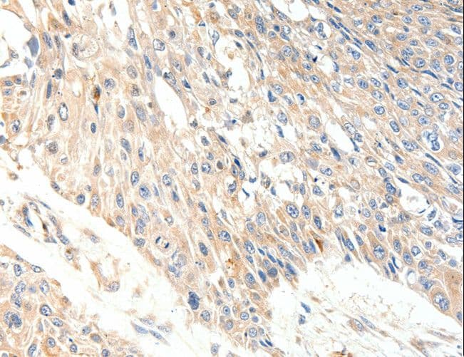 SLC27A1 / FATP Antibody
