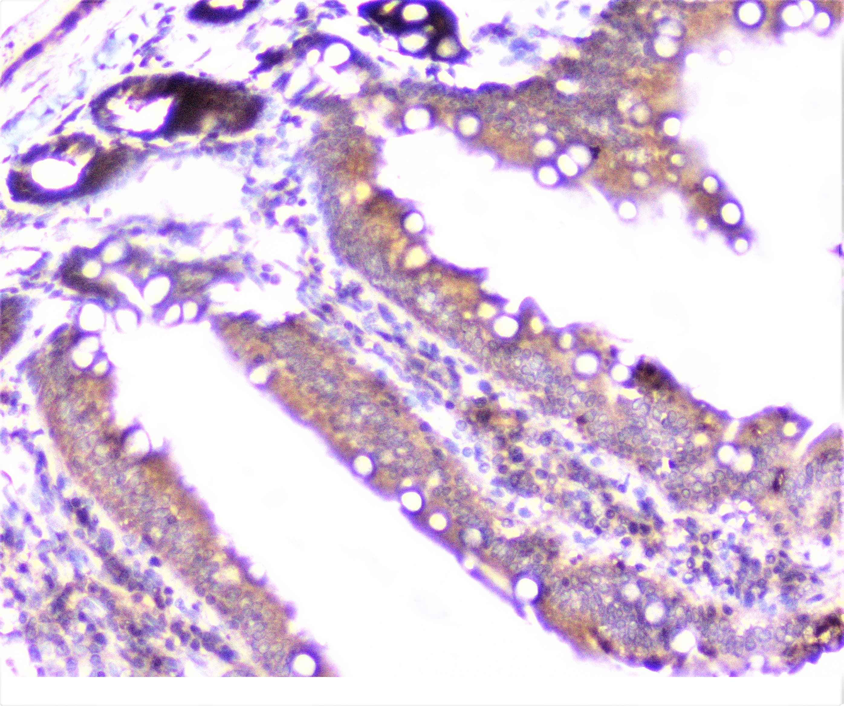 CTTN / Cortactin Antibody
