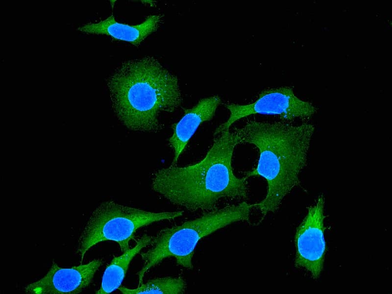 IHC-plus™ Testilin / EHD1 Antibody (Internal, clone EPR4955)