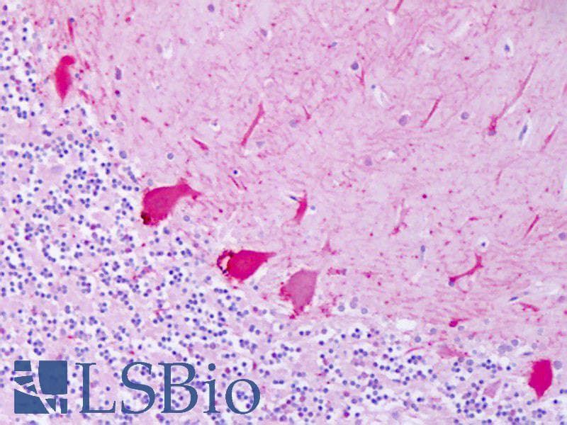IHC-plus™ Polyclonal Rabbit anti-Human ADRB2 Antibody (N-Terminus, IHC)