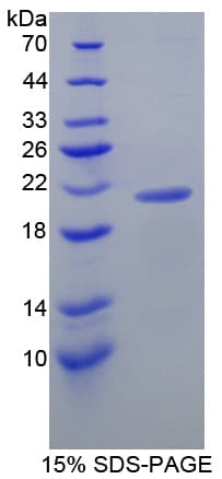 Mouse LCN8 Protein (Recombinant His-T7)