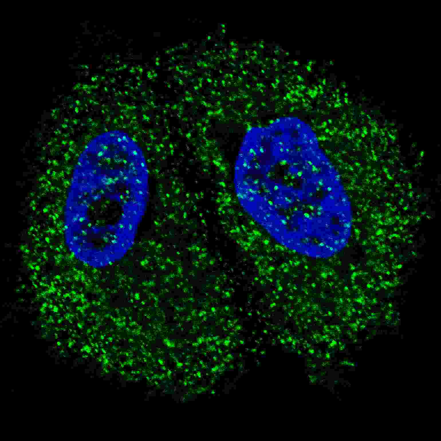 Polyclonal Rabbit anti-Human PKM / Pyruvate Kinase, Muscle Antibody (aa476-505, IHC, IF, WB)