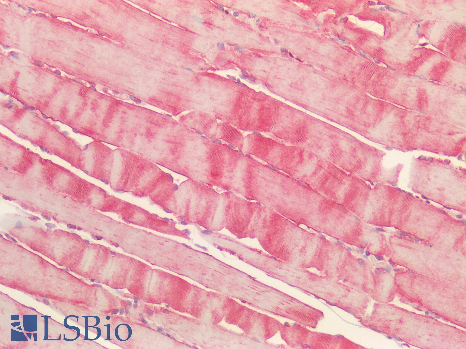 ORAOV1 Antibody