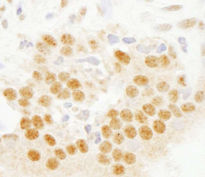 SETD7 / SET7 Antibody (aa316-366)
