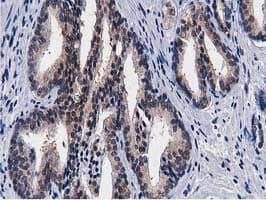 ERIC-1 / TACC3 Antibody (clone OTI3B1)