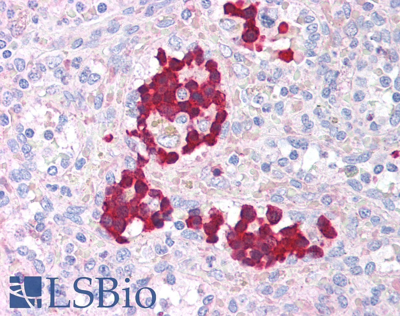IHC-plus™ AURKB / Aurora-B Antibody