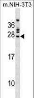 FGFR1OP2 Antibody (aa140-166)