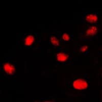 XRCC6 / Ku70 Antibody (C-Terminus)