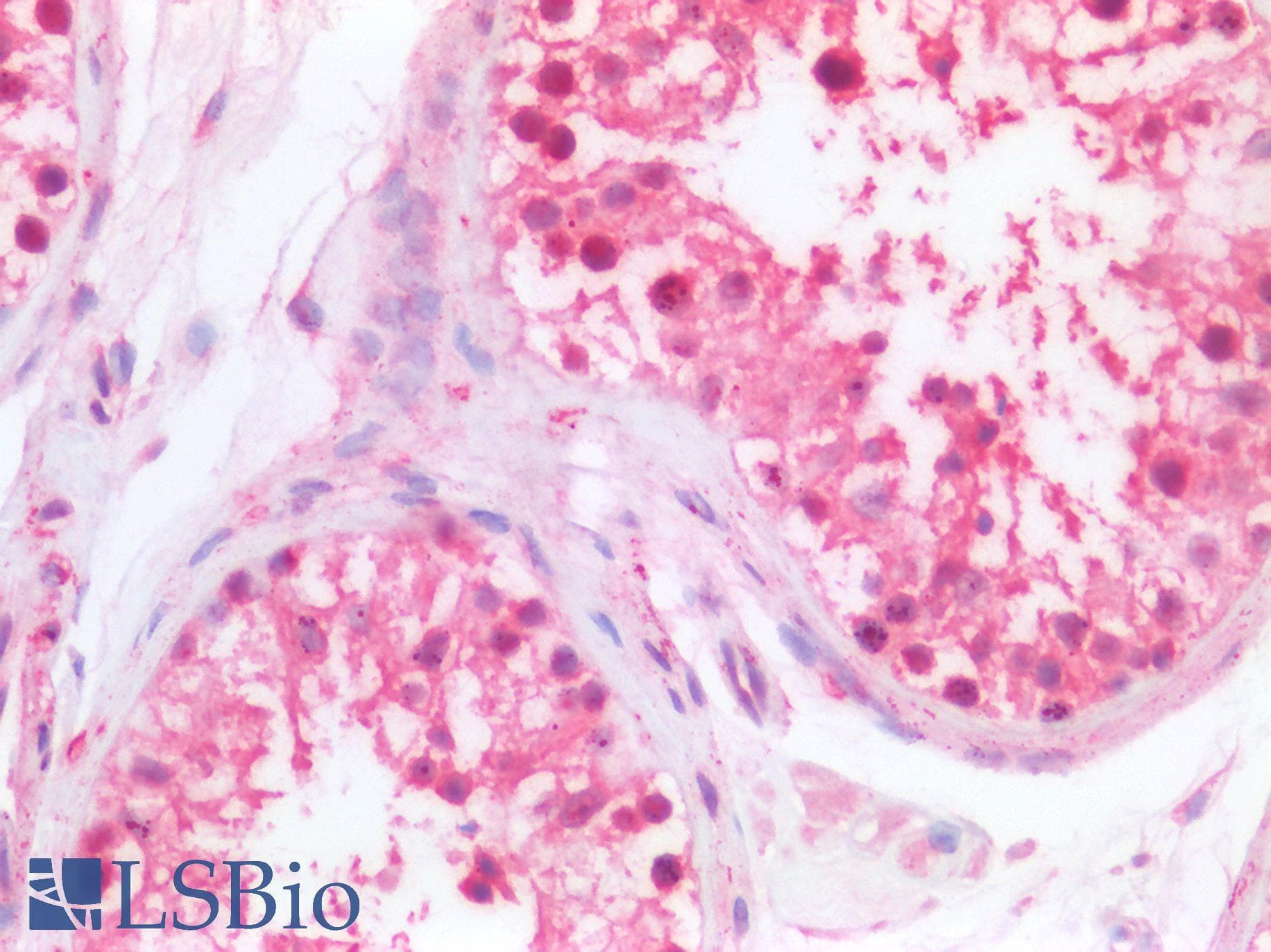 PathPlus™ p84 / THOC1 Antibody (aa1-404)