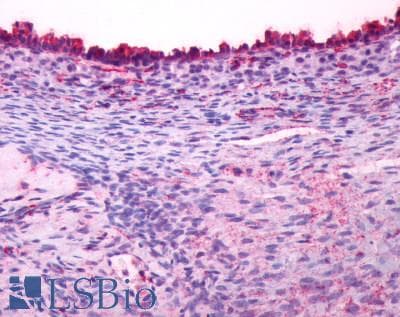 PathPlus™ LHCGR / LHR / LH Receptor Antibody (C-Terminus)