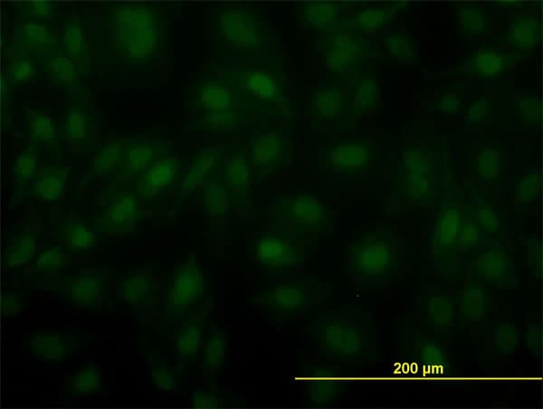 IHC-plus™ Monoclonal Mouse anti-Human ARNT / HIF-1-Beta Antibody (clone 3D10, IHC, IF, WB)
