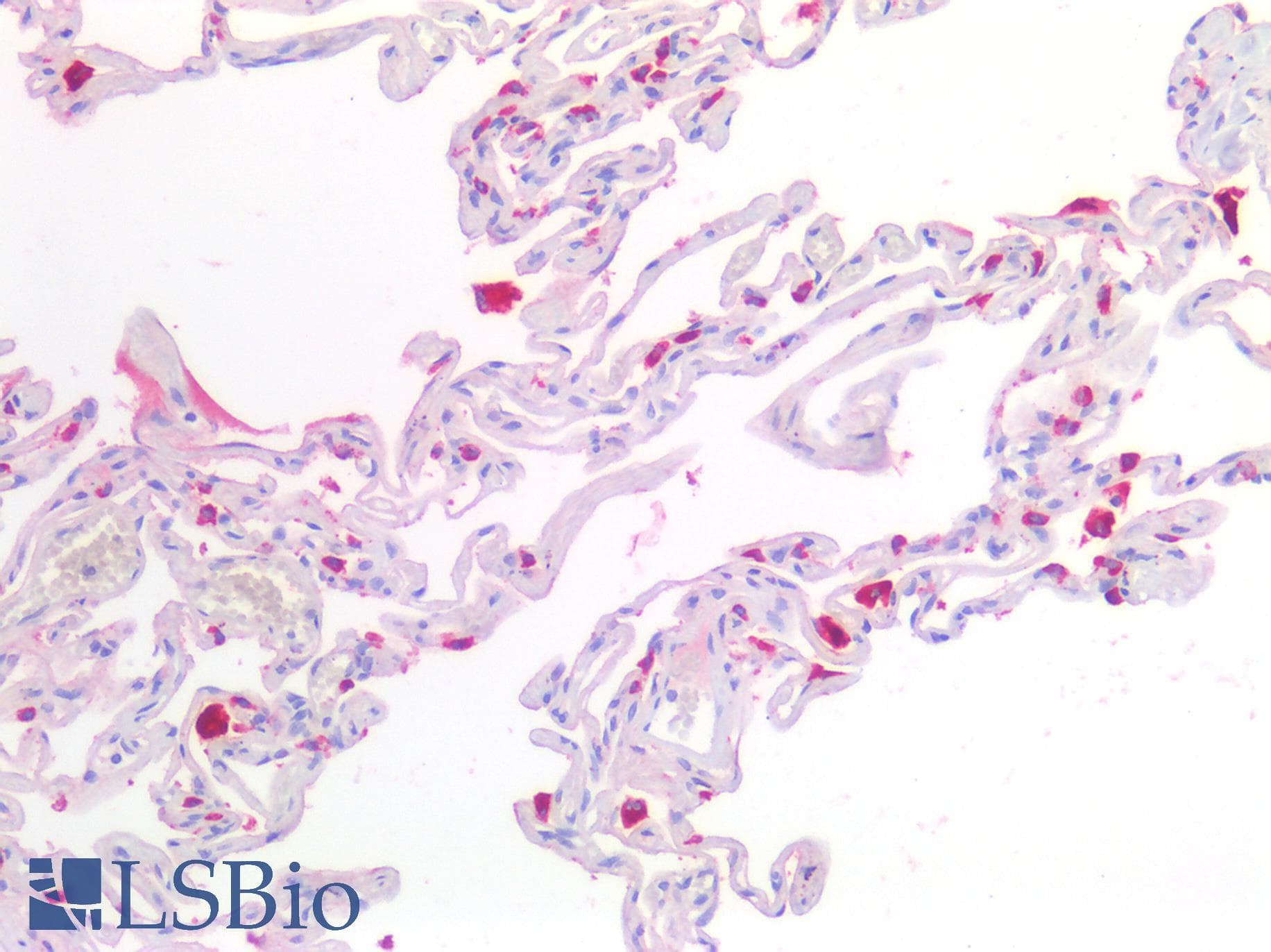 IHC-plus™ NAPSA / NAPA / Napsin A Antibody