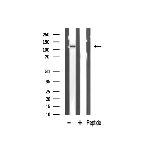 Polyclonal Rabbit anti-Human ZMYND8 / RACK7 Antibody (IF, WB)