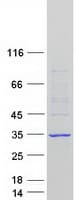 Human FIGLA Protein (Recombinant Myc-DDK (Flag))