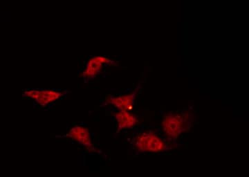 Polyclonal Rabbit anti-Human OR2C3 Antibody (IHC, IF, WB)