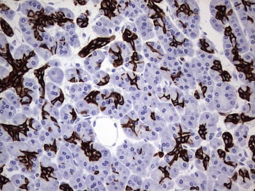 Monoclonal Mouse anti-Human KRT19 / CK19 / Cytokeratin 19 Antibody (clone OTI5H6, aa240-390, IHC, WB)