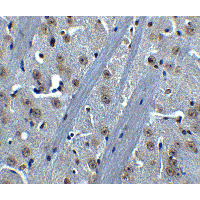 BTK Antibody