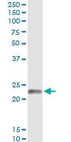 EDN1 / Endothelin 1 Antibody (clone 3D6)