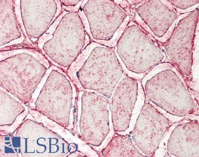 IHC-plus™ CRYAB / Alpha B Crystallin Antibody (clone 4A6)