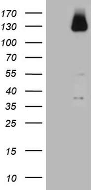 ZNF217 Antibody (aa730-1048, clone OTI1B10)