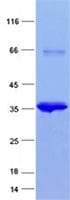 Human LAMA3 / Laminin Alpha 3 Protein (Recombinant His, N-Terminal)