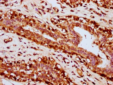 HIST1H4I Antibody