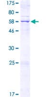 Human MCU / CCDC109A Protein (Recombinant GST)