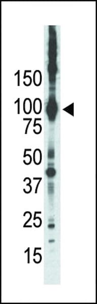 PRKCE / PKC-Epsilon Antibody (aa206-236)